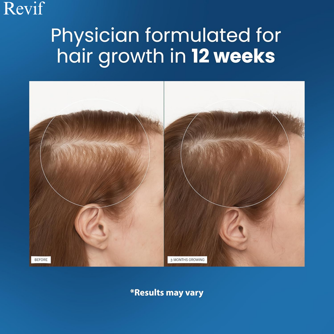 Revif Hair Surge™ Roll-On Serum