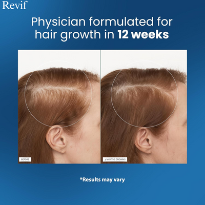 Revif Hair Surge™ Roll-On Serum